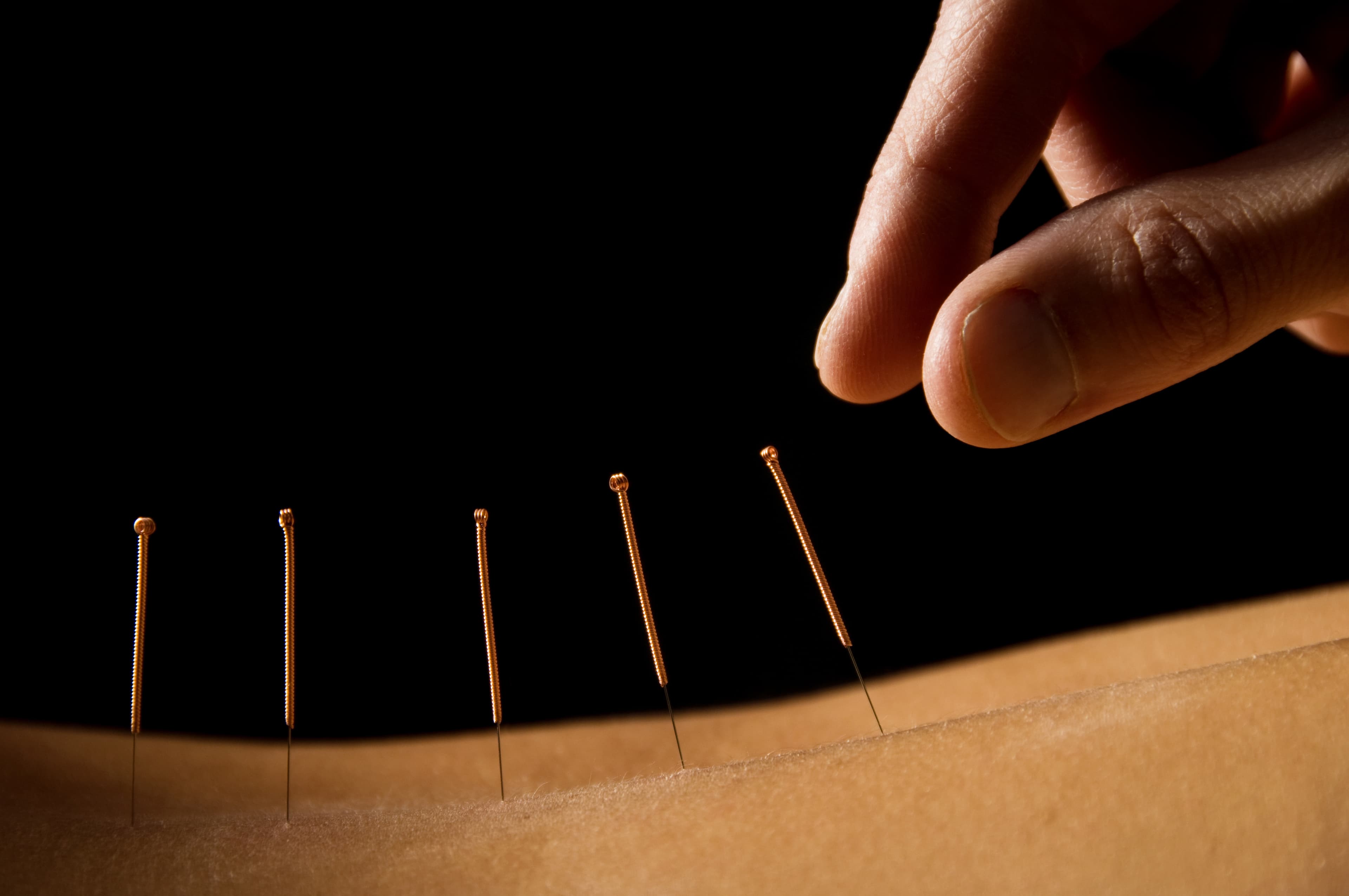 Acupuncture - 60 min